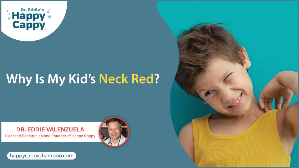 Why is my kid’s neck red?