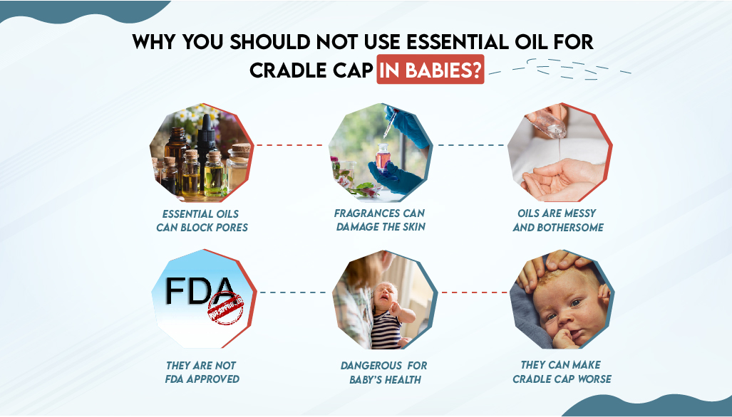 Why You Should Not Use Essential Oil for Cradle Cap in Babies?