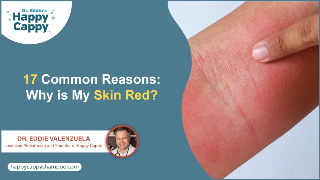 17 Common Reasons: Why is My Skin Red?