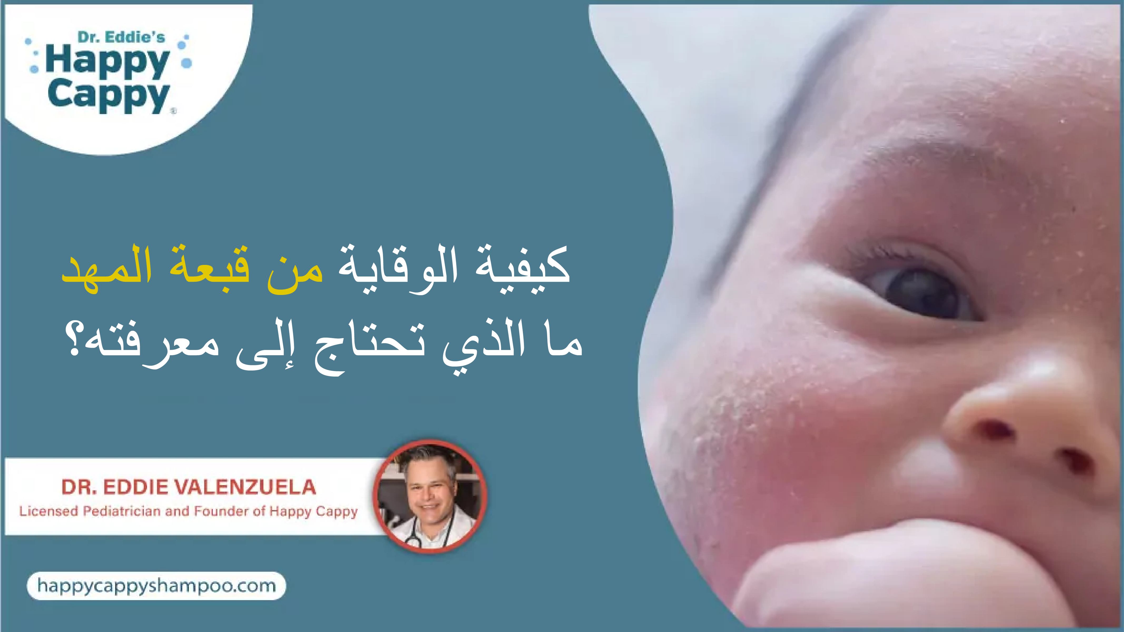 كيفية الوقاية من قبعة المهد: ما الذي تحتاج إلى معرفته؟