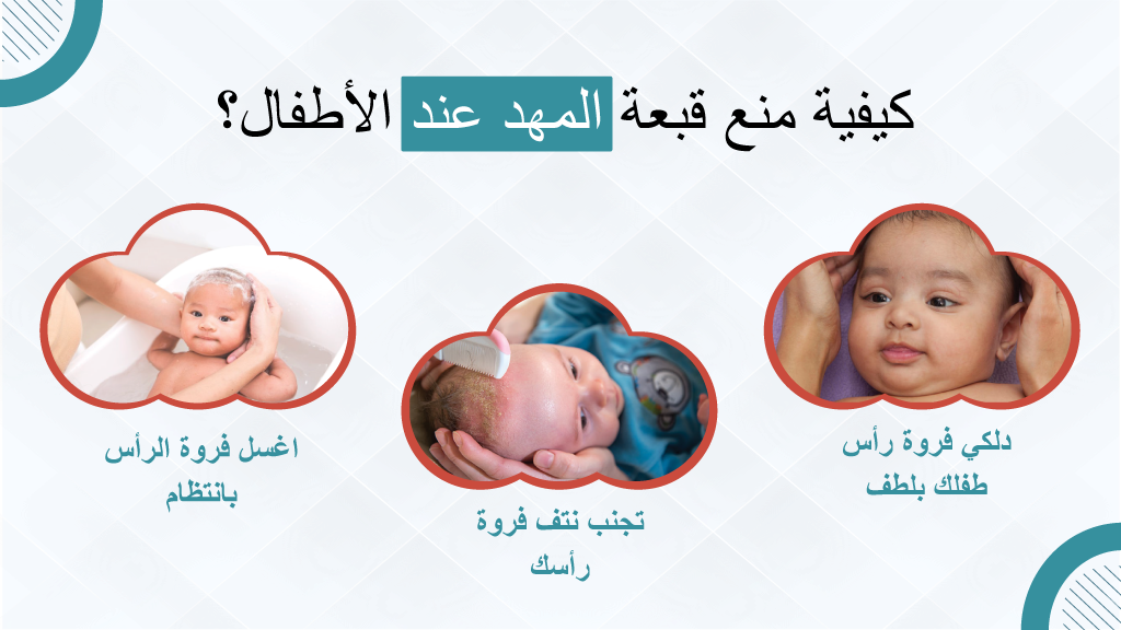 كيفية منع قبعة المهد عند الأطفال