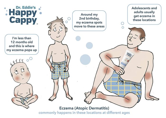 2 Pack Moisturizing Eczema Cream For Baby | Happy Cappy