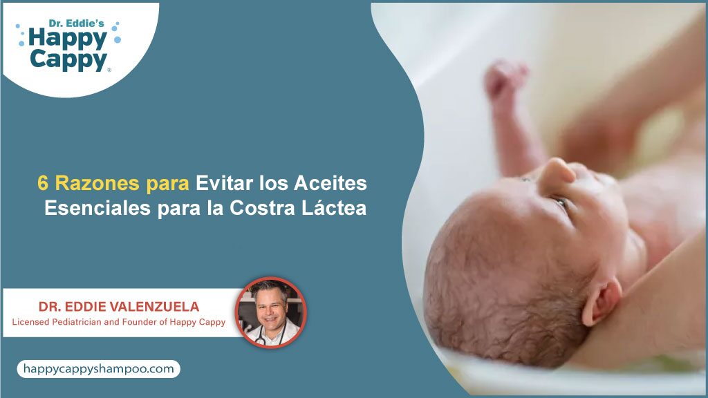 6 Razones para Evitar los Aceites Esenciales para la Costra Láctea