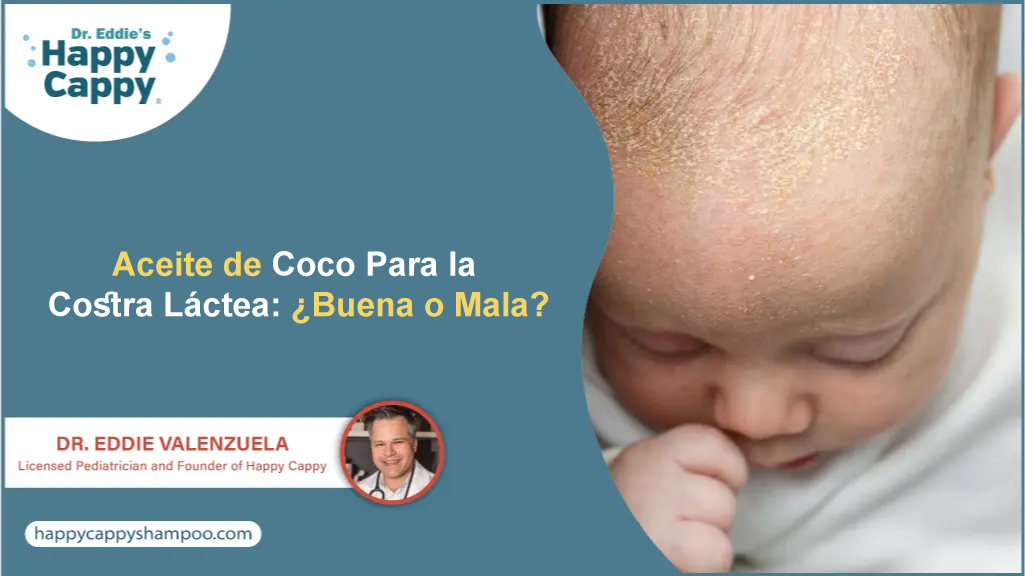 Aceite de Coco Para la Costra Láctea: ¿Buena o Mala?