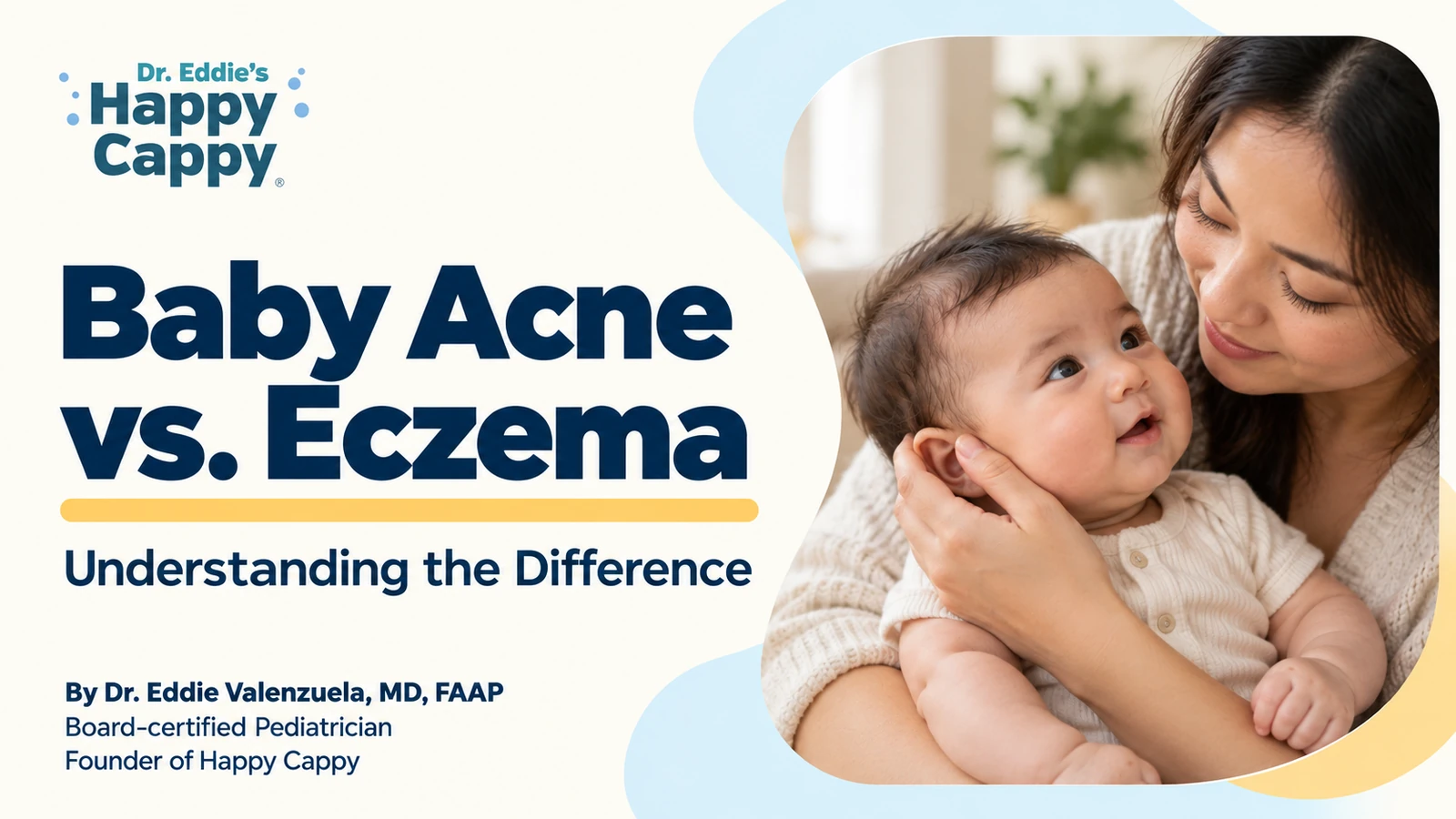 Baby Acne vs. Eczema: Understanding The Difference
