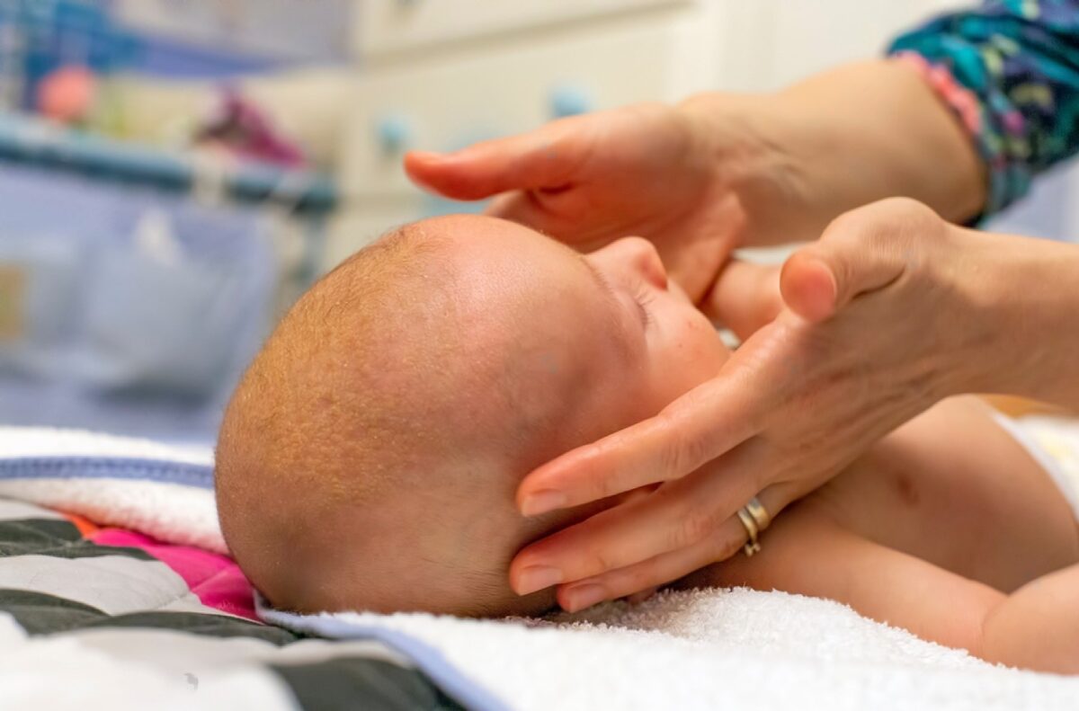 Toddler Cradle Cap: What Every Parent Should Know