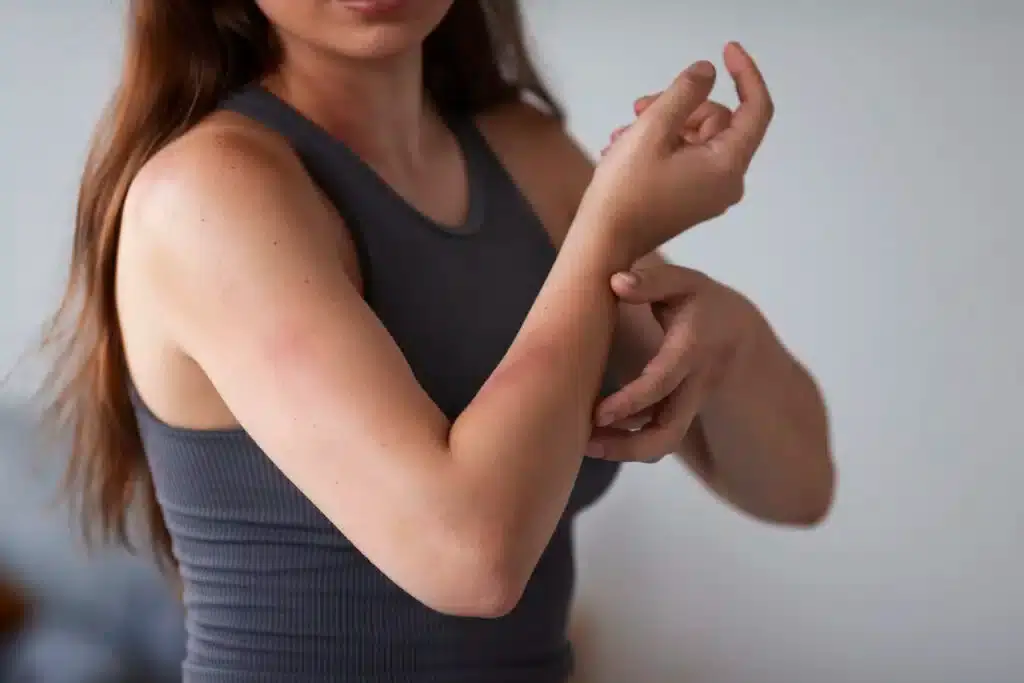 Why is my Skin Itching: Understanding the Causes