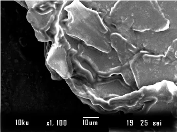What Dandruff Looks Like Under a Microscope