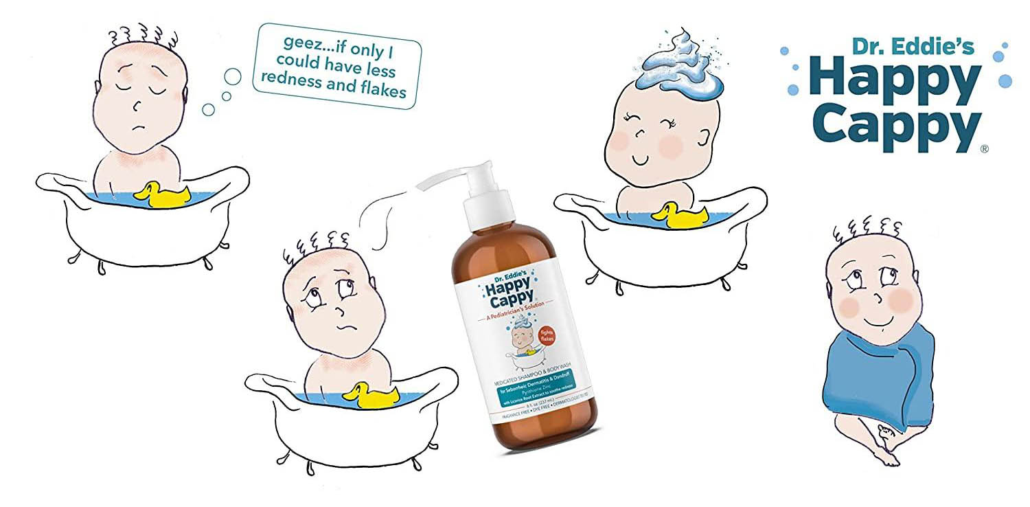 Choosing The Right Cradle Cap Shampoo For Babies