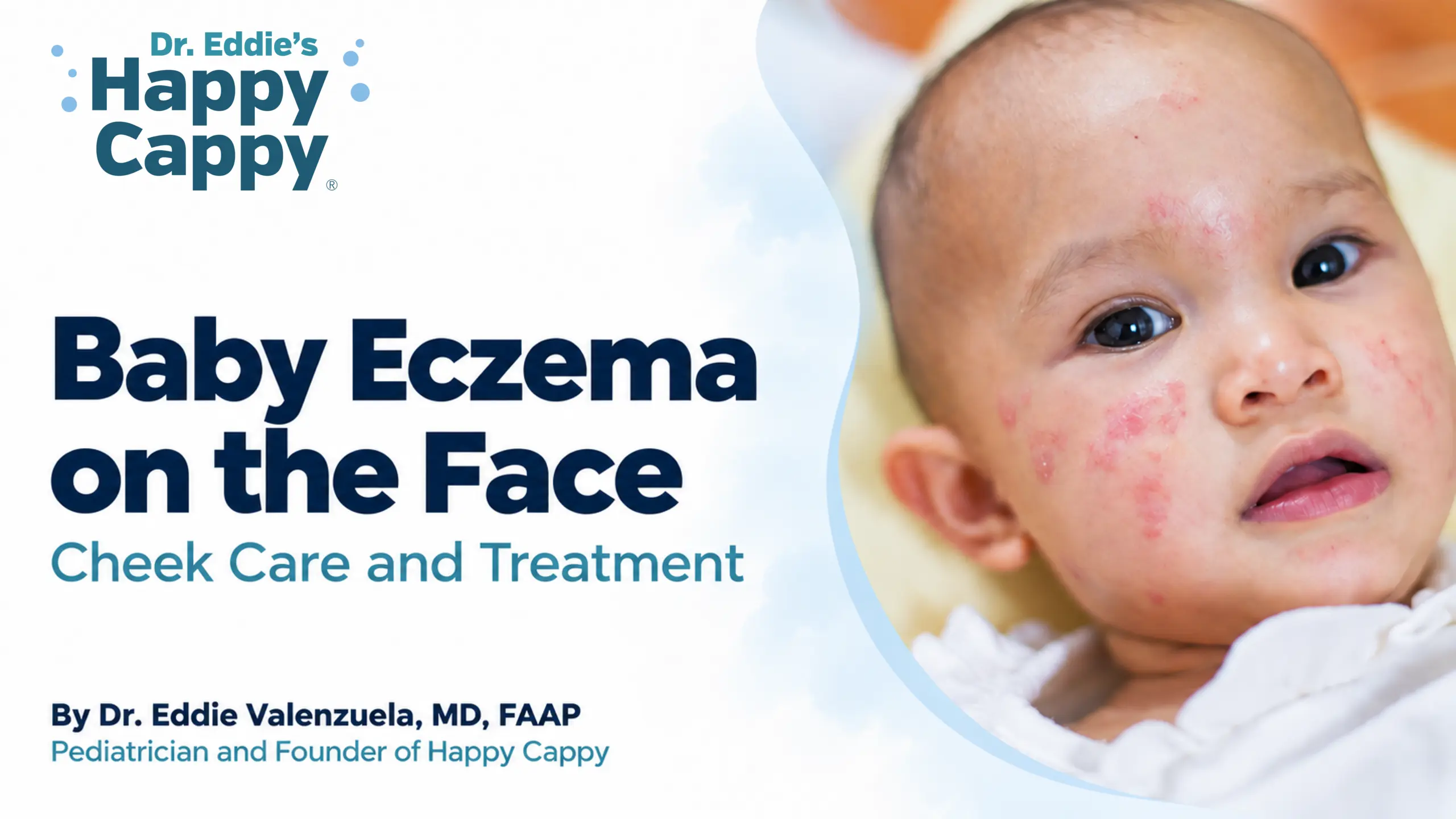 Baby Eczema on the Face: Cheek Care and Treatment