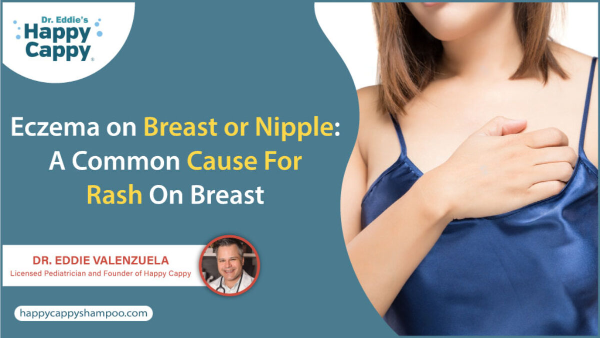 Breast Eczema: Symptoms, Causes, and Treatment