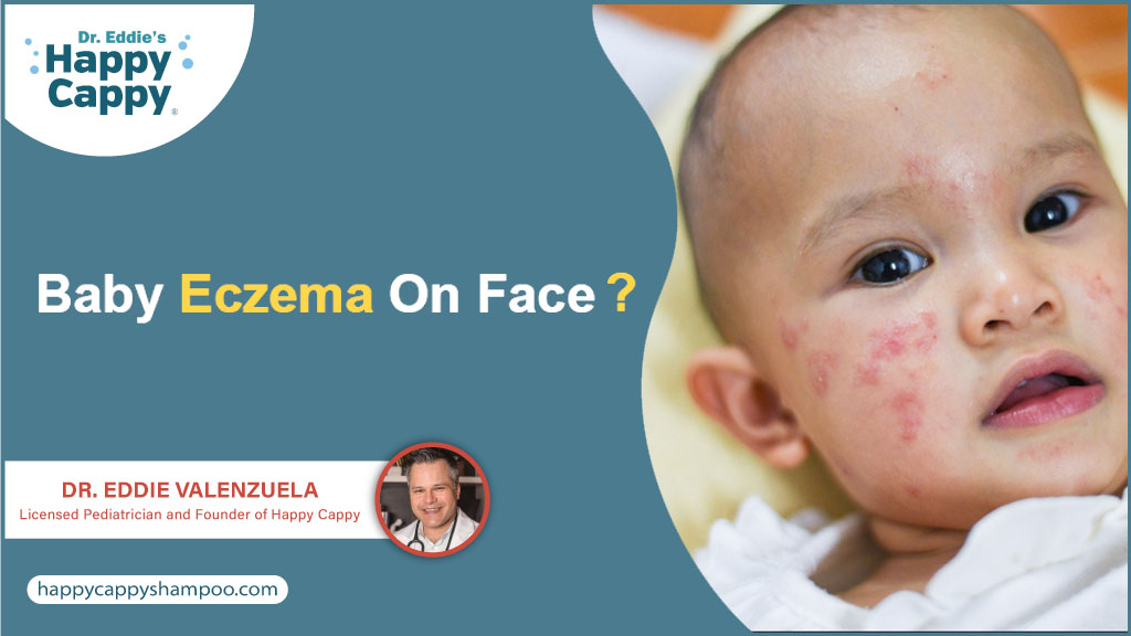 تهدئة بشرة طفلك: التعامل مع إكزيما الأطفال على الوجه