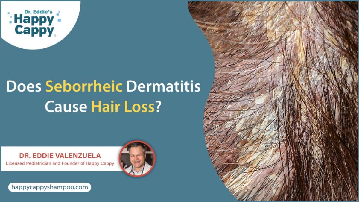 Dermatitis seborreica es una afección que puede generar alopecia si no se  trata - Empresa 