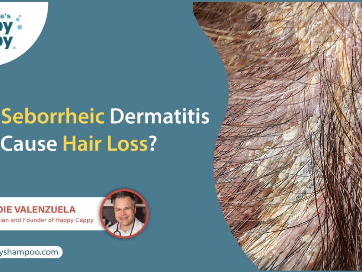 Cómo afecta la dermatitis seborreica al pelo y cuero cabelludo? - ITC  Medical