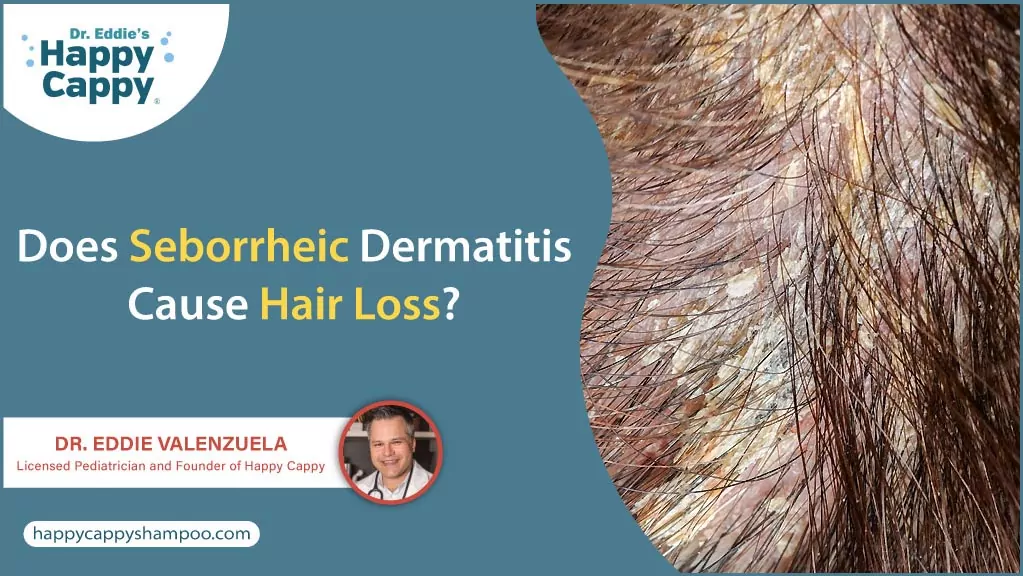 هل يسبب التهاب الجلد الدهني تساقط الشعر؟