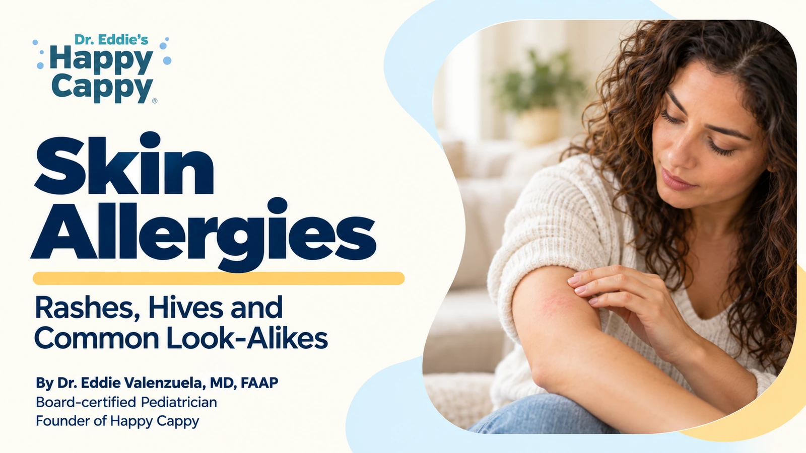 Skin Allergies: Rashes, Hives and Common Look-Alikes