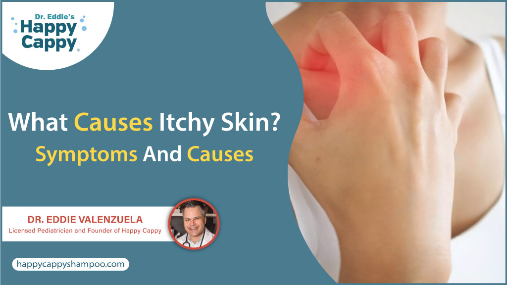 what cause itchy skin