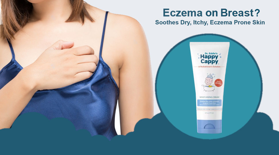 How To Treat Eczema On Your Breast?