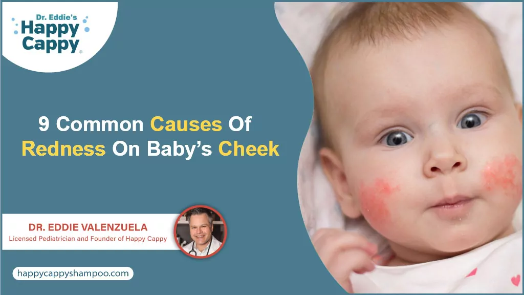 9 Common Causes Of Redness On Baby’s Cheek