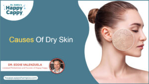 Understanding The Causes Of Dry Skin: Your Ultimate Guide