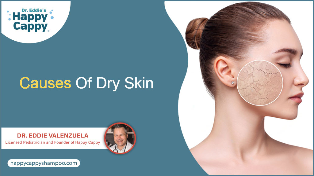 Understanding The Causes Of Dry Skin Your Ultimate Guide