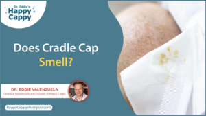 Does cradle cap smell