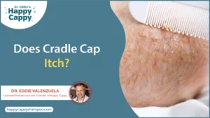 Does cradle cap itch?
