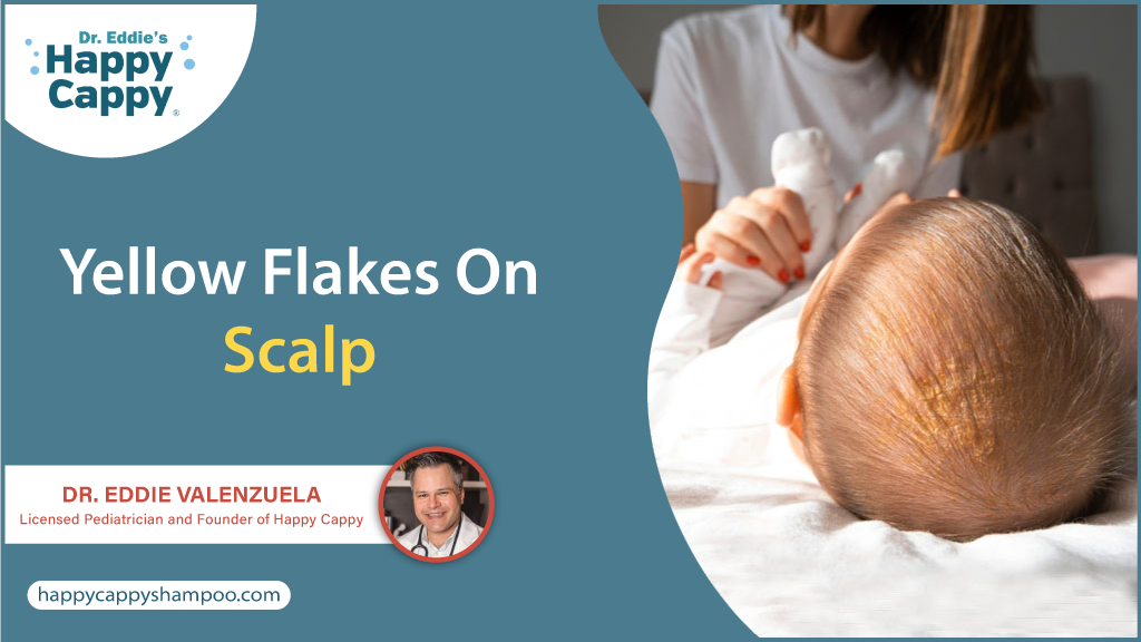 Yellow Flakes on Scalp | Dr. Eddie's Happy Cappy