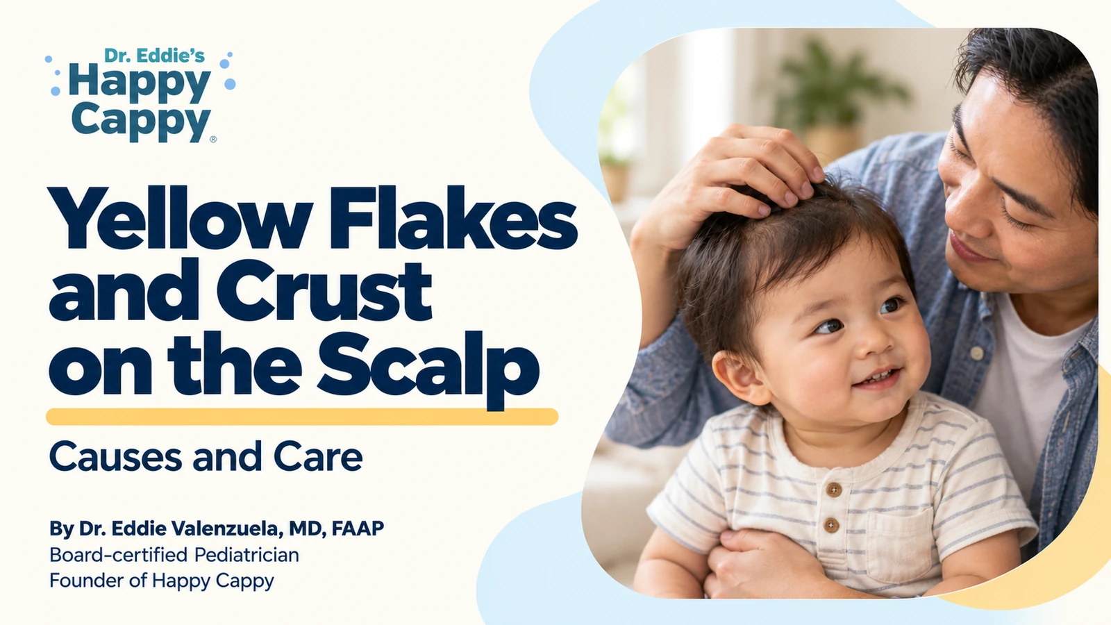 Yellow Flakes and Crust on the Scalp: Causes and Care