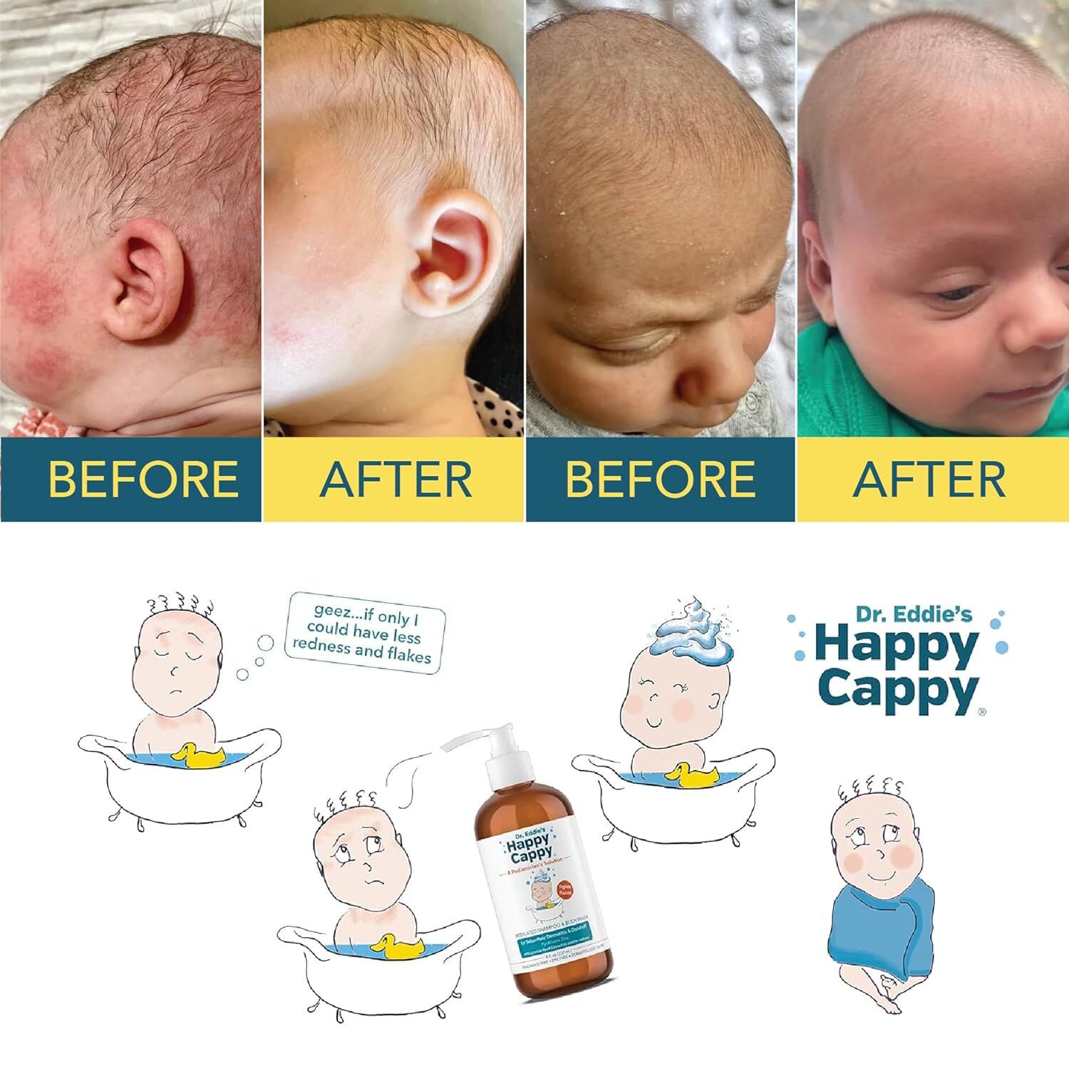 Two before-and-after pairs showing changes in visible scalp scale and skin redness.