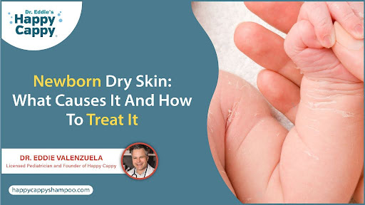 Newborn Dry Skin: What Causes It And How To Treat It