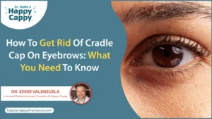 How To Get Rid of Cradle Cap on Eyebrows