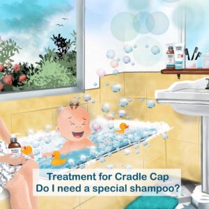 Treatment for cradle cap do i need a special shampoo
