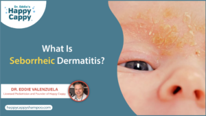 What Is Seborrheic Dermatitis?