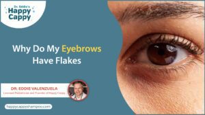 Why Do My Eyebrows Have Flakes