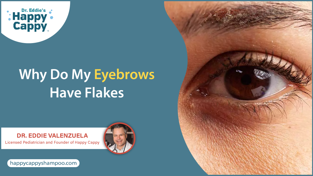 Why do my eyebrows have flakes? Dr. Eddie Valenzuela