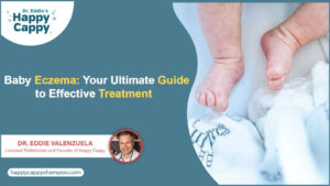 Baby Eczema: Your Ultimate Guide to Effective Treatment