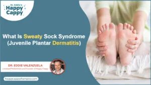 What Is Sweaty Sock Syndrome (Juvenile Plantar Dermatitis)