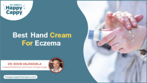 Best Hand Cream For Eczema 