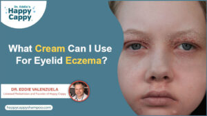 What cream can i use for eyelid eczema