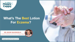 What’s The Best Lotion For Eczema?