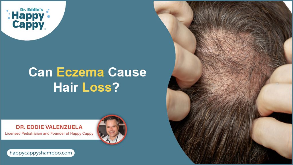 Happy Cappy guide to eczema and hair loss, with a close view of a person parting the hair