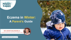 Eczema in Winter A Parent’s Guide