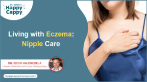 Living with Eczema Nipple Care