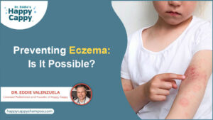 Preventing Eczema Is It Possible