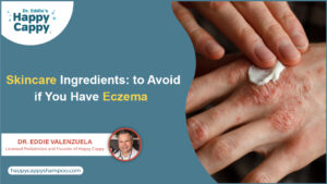 Skincare Ingredients to Avoid if You Have Eczema