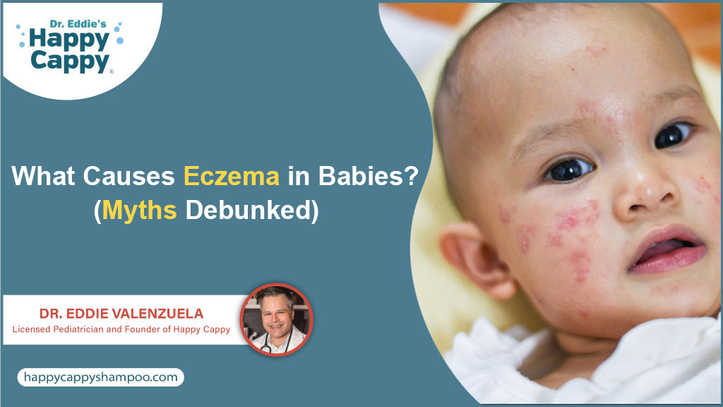 What Causes Eczema in Babies? Myths Debunked