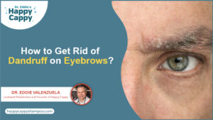 How to Get Rid of Dandruff on Eyebrows