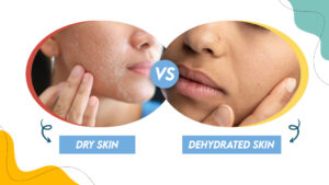 Dehydrated Skin Vs Dry Skin