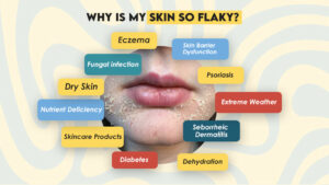 Why is My Skin So Flaky?